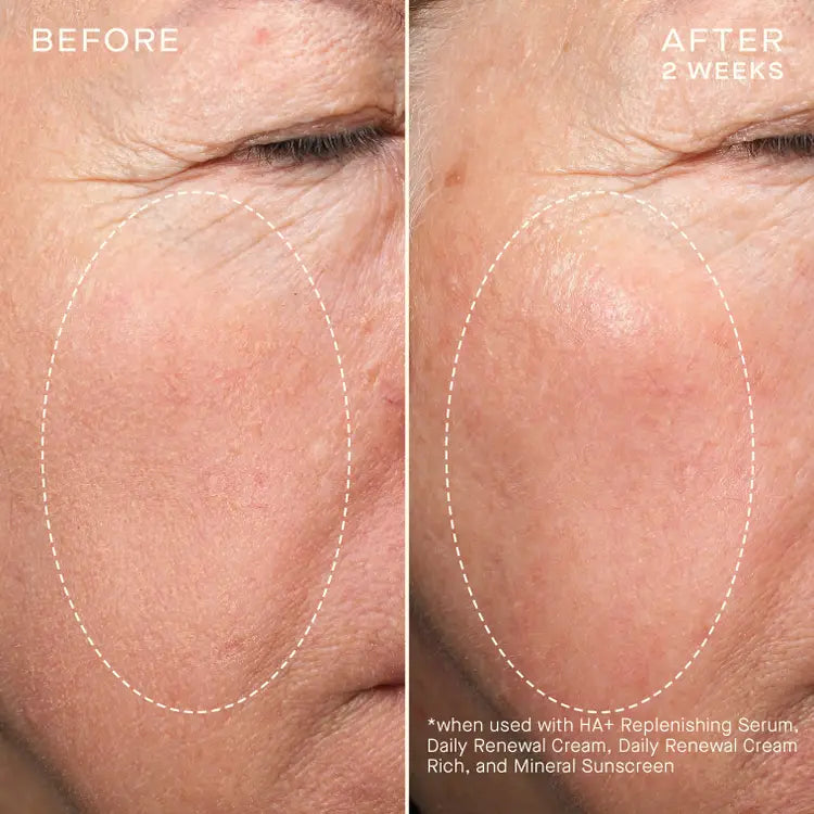 OurSelf Advanced Regenerative Serum