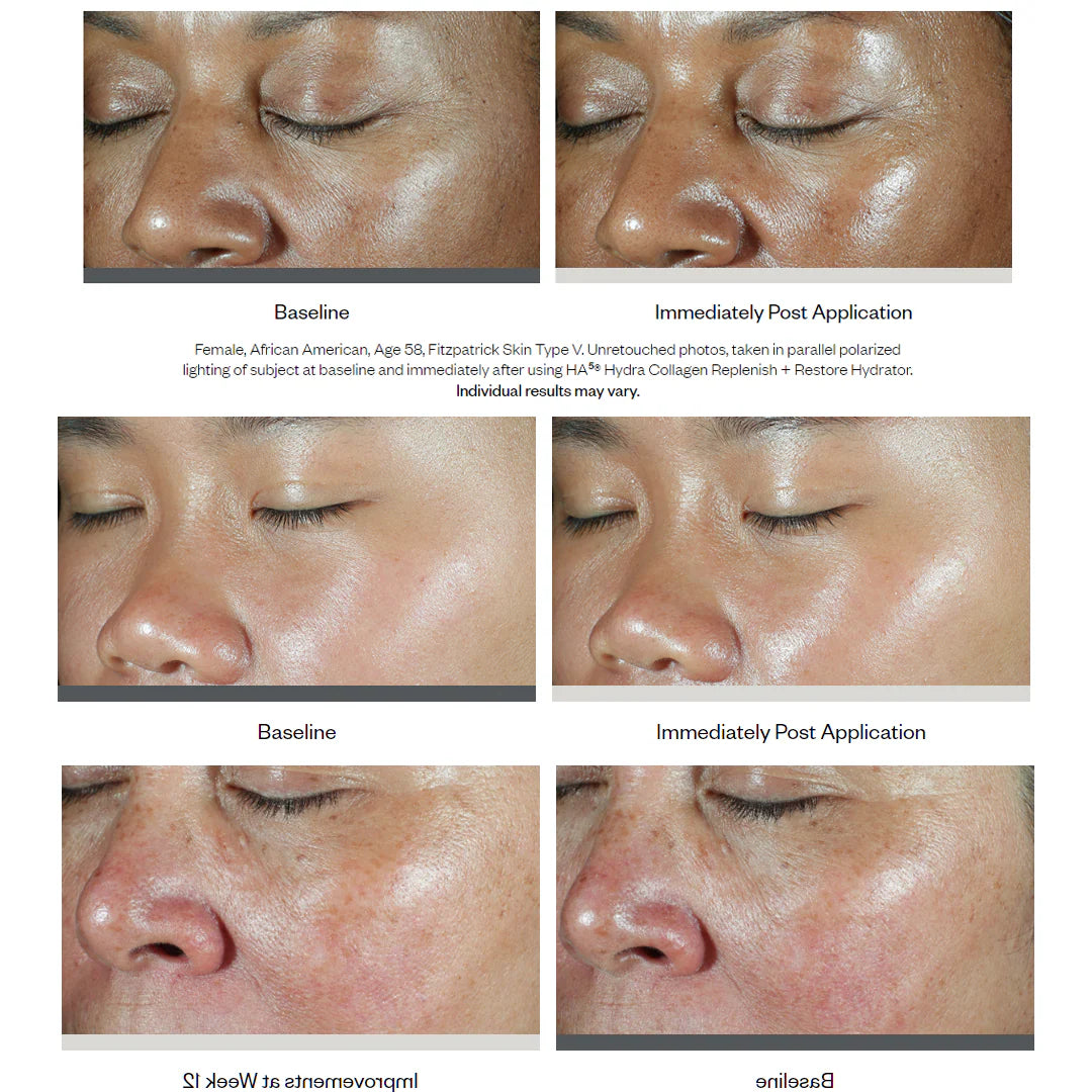 SkinMedica HA5 Collagen Replenish + Restore