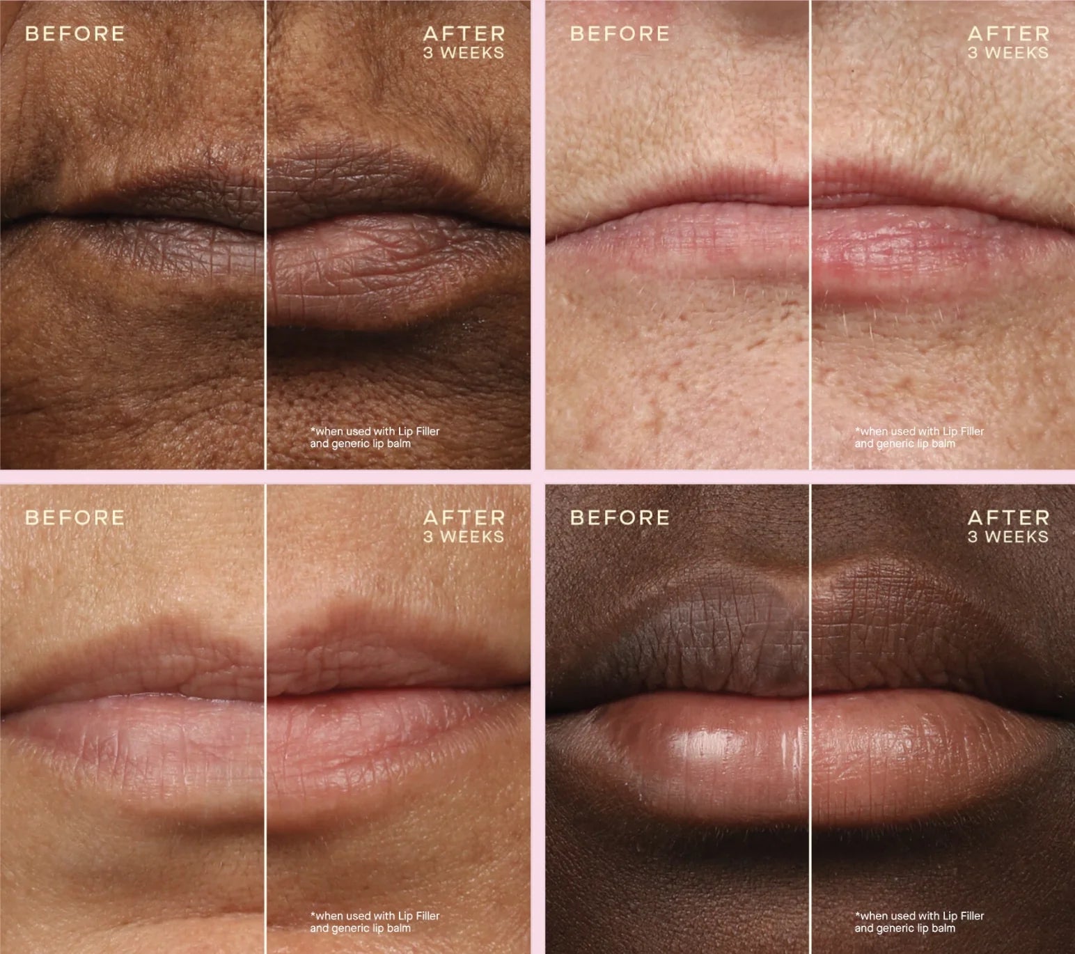 Ourself Lip Filler Pen + 1 Refill