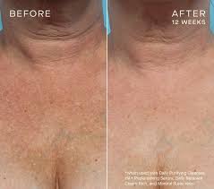 Ourself HA + Replenishing Serum