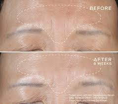 Ourself HA + Replenishing Serum