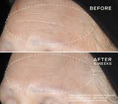 Ourself HA + Replenishing Serum